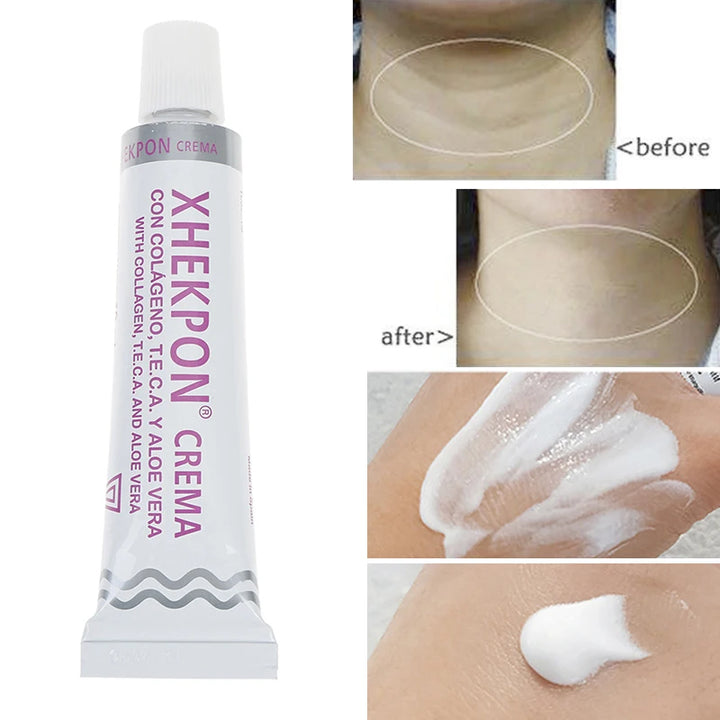 Neck Anti-Wrinkle Cream Reduce Neck Fine Lines